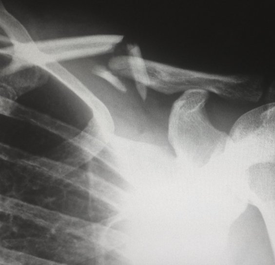 Pomoč pri sanaciji po&scaron;kodb